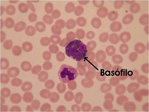 basofilos bajos