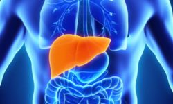 hepatitis