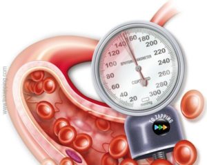 hipertension-arterial
