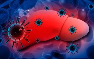 hepatitis